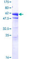 EEF1D Protein - 12.5% SDS-PAGE of human EEF1D stained with Coomassie Blue