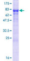 EFCAB14 Protein - 12.5% SDS-PAGE of human KIAA0494 stained with Coomassie Blue
