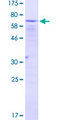EIF2S2 Protein - 12.5% SDS-PAGE of human EIF2S2 stained with Coomassie Blue