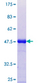 EIF2S2 Protein - 12.5% SDS-PAGE Stained with Coomassie Blue.