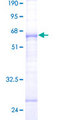 EIF4E2 / IF4e Protein - 12.5% SDS-PAGE of human EIF4E2 stained with Coomassie Blue