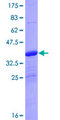 EIF4EBP3 Protein - 12.5% SDS-PAGE of human EIF4EBP3 stained with Coomassie Blue