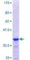 ELKS / ERC1 Protein - 12.5% SDS-PAGE Stained with Coomassie Blue.