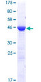 EMC9 Protein - 12.5% SDS-PAGE of human C14orf122 stained with Coomassie Blue