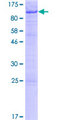EME1 Protein - 12.5% SDS-PAGE of human EME1 stained with Coomassie Blue