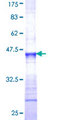 EML1 / EMAP Protein - 12.5% SDS-PAGE Stained with Coomassie Blue.