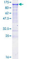 EPB41L1 / 4.1N Protein - 12.5% SDS-PAGE of human EPB41L1 stained with Coomassie Blue