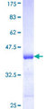 EPB41L1 / 4.1N Protein - 12.5% SDS-PAGE Stained with Coomassie Blue.