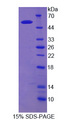 EPB42 Protein - Recombinant Erythrocyte Membrane Protein Band 4.2 By SDS-PAGE