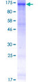EPHB3 / EPH Receptor B3 Protein - 12.5% SDS-PAGE of human EPHB3 stained with Coomassie Blue