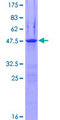 EPN3 Protein - 12.5% SDS-PAGE of human EPN3 stained with Coomassie Blue
