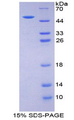 EPO / Erythropoietin Protein - Recombinant Erythropoietin By SDS-PAGE
