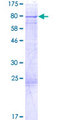 EPS8L1 Protein - 12.5% SDS-PAGE of human EPS8L1 stained with Coomassie Blue