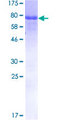 ERCC6L / FLJ20105 Protein - 12.5% SDS-PAGE of human ERCC6L stained with Coomassie Blue