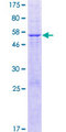 ETFBKMT Protein - 12.5% SDS-PAGE of human MGC50559 stained with Coomassie Blue