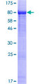 EXD1 Protein - 12.5% SDS-PAGE of human EXDL1 stained with Coomassie Blue
