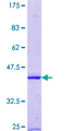 EXOG / ENDOGL1 Protein - 12.5% SDS-PAGE Stained with Coomassie Blue.