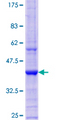 EXOSC3 Protein - 12.5% SDS-PAGE Stained with Coomassie Blue.