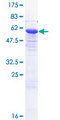 EXOSC7 Protein - 12.5% SDS-PAGE of human EXOSC7 stained with Coomassie Blue