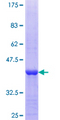 EXOSC8 Protein - 12.5% SDS-PAGE Stained with Coomassie Blue.