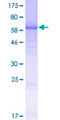 FAM102B Protein - 12.5% SDS-PAGE of human FAM102B stained with Coomassie Blue