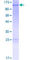 FAM13C1 / FAM13C Protein - 12.5% SDS-PAGE of human FAM13C1 stained with Coomassie Blue
