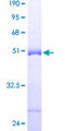 FAM206A / C9orf6 Protein - 12.5% SDS-PAGE of human FLJ20457 stained with Coomassie Blue