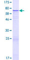 FAM20B Protein - 12.5% SDS-PAGE of human FAM20B stained with Coomassie Blue