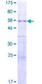 FAM60A Protein - 12.5% SDS-PAGE of human FAM60A stained with Coomassie Blue