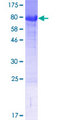 FAM63A Protein - 12.5% SDS-PAGE of human FAM63A stained with Coomassie Blue