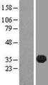 FAM70B Protein - Western validation with an anti-DDK antibody * L: Control HEK293 lysate R: Over-expression lysate