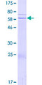 FAM71F1 Protein - 12.5% SDS-PAGE of human FAM71F1 stained with Coomassie Blue