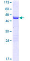 FAM78A Protein - 12.5% SDS-PAGE of human FAM78A stained with Coomassie Blue