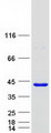 FANK1 Protein - Purified recombinant protein FANK1 was analyzed by SDS-PAGE gel and Coomassie Blue Staining