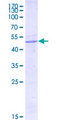 FATE1 Protein - 12.5% SDS-PAGE Stained with Coomassie Blue