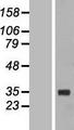 FBG4 / FBXO17 Protein - Western validation with an anti-DDK antibody * L: Control HEK293 lysate R: Over-expression lysate