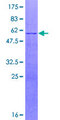 FBXL18 Protein - 12.5% SDS-PAGE of human FBXL18 stained with Coomassie Blue