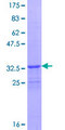 FBXL21 Protein - 12.5% SDS-PAGE of human FBXL21 stained with Coomassie Blue