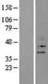 FBXO15 / FBX15 Protein - Western validation with an anti-DDK antibody * L: Control HEK293 lysate R: Over-expression lysate