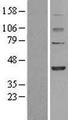 FBXO28 Protein - Western validation with an anti-DDK antibody * L: Control HEK293 lysate R: Over-expression lysate