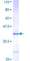 FBXO40 Protein - 12.5% SDS-PAGE Stained with Coomassie Blue.