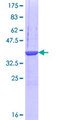 FBXO41 Protein - 12.5% SDS-PAGE Stained with Coomassie Blue.