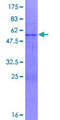 FBXO44 Protein - 12.5% SDS-PAGE of human FBXO44 stained with Coomassie Blue