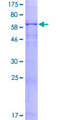 FCGR1A / CD64 Protein - 12.5% SDS-PAGE of human FCGR1A stained with Coomassie Blue