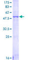 FCGR3A / CD16A Protein - 12.5% SDS-PAGE of human FCGR3A stained with Coomassie Blue