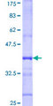 FCRL2 / IRTA4 Protein - 12.5% SDS-PAGE Stained with Coomassie Blue.