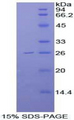 FGFR4 Protein - Recombinant Fibroblast Growth Factor Receptor 4 By SDS-PAGE