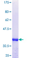 FHL3 Protein - 12.5% SDS-PAGE Stained with Coomassie Blue.