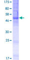 FITM1 Protein - 12.5% SDS-PAGE of human LOC161247 stained with Coomassie Blue