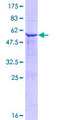 FKBP14 Protein - 12.5% SDS-PAGE of human FKBP14 stained with Coomassie Blue